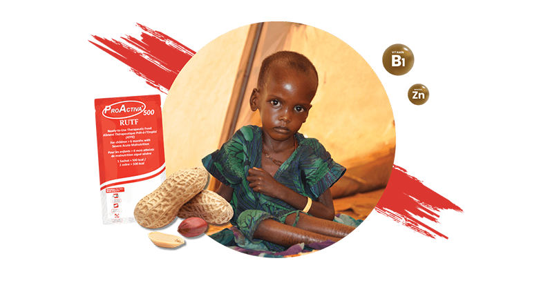 RUTF (Ready to use Therapeutic Food ) in Bangladesh