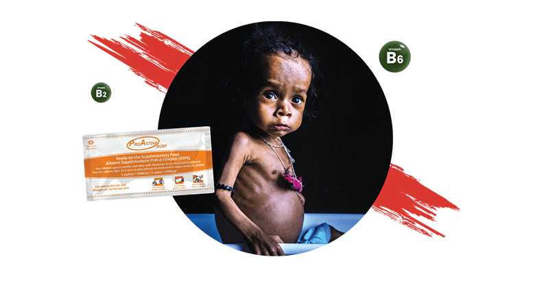 RUSF (Ready to eat Supplementary Food ) in Bangladesh